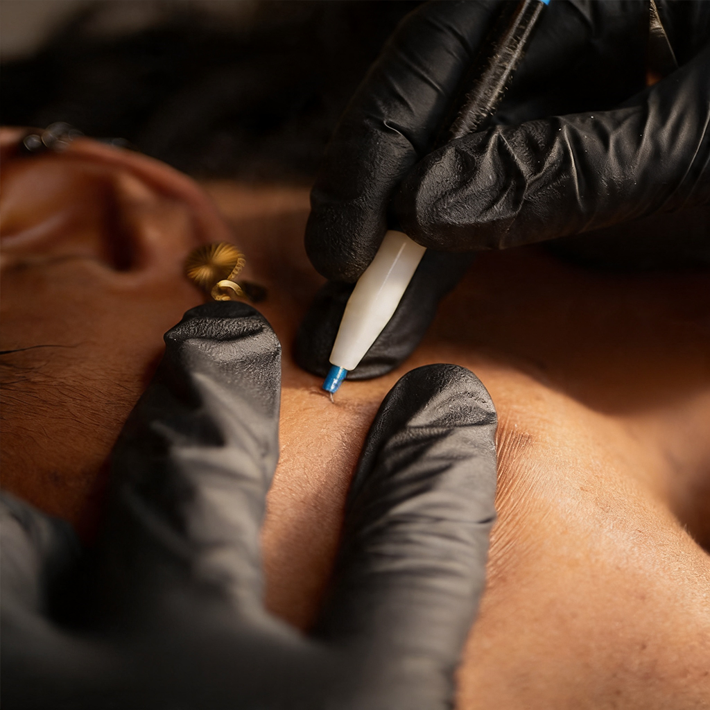 epilation-electrolyse-gaia-spa-sxm